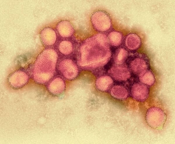 2009 H1N1 swine flu virus, TEM