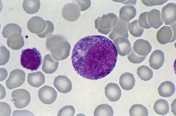Promyelocyte blood cell, light micrograph