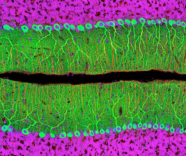 Purkinje nerve cells in the cerebellum