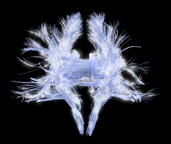 White matter fibres of the human brain C014  /  5672