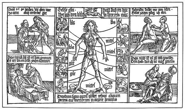 German astrological bloodletting chart used by barber surgeons as fair posters, 1480