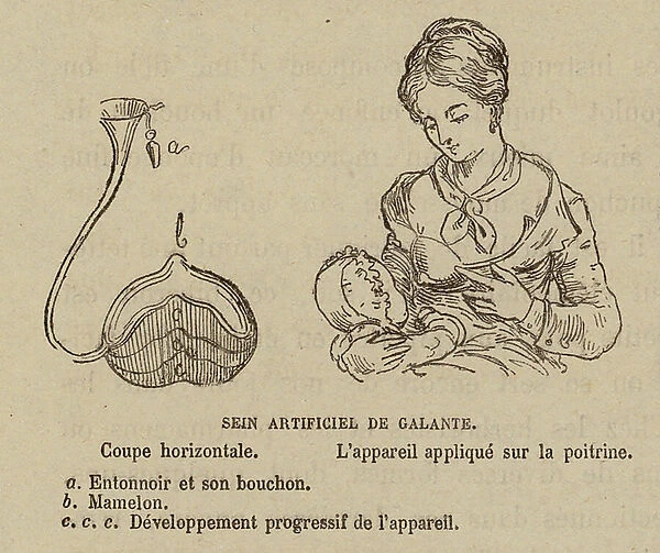 Artificial breastfeeding device (engraving)