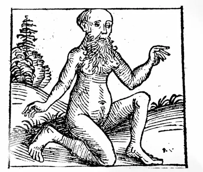 Framed Print : A beared man with breasts
