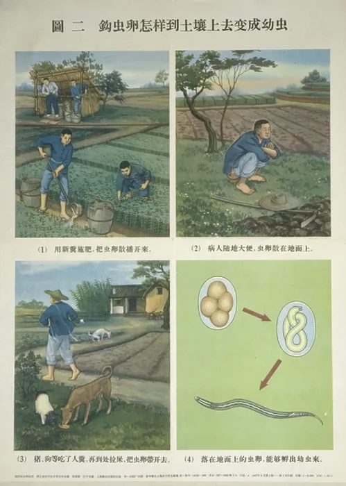 Framed Print : Defecation Spreads the Hookworm