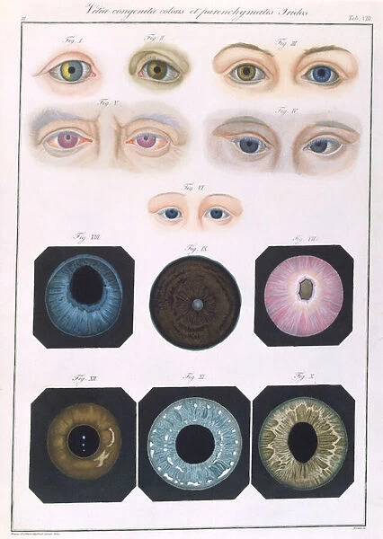 Description of congenital eye anomalies, from Klinische Darstellungen der