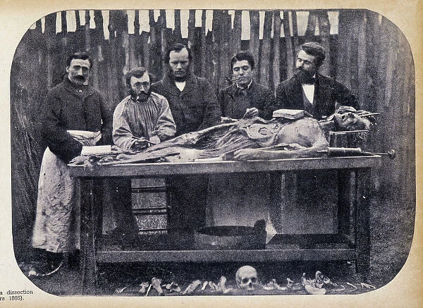 Dissection, v. 1865