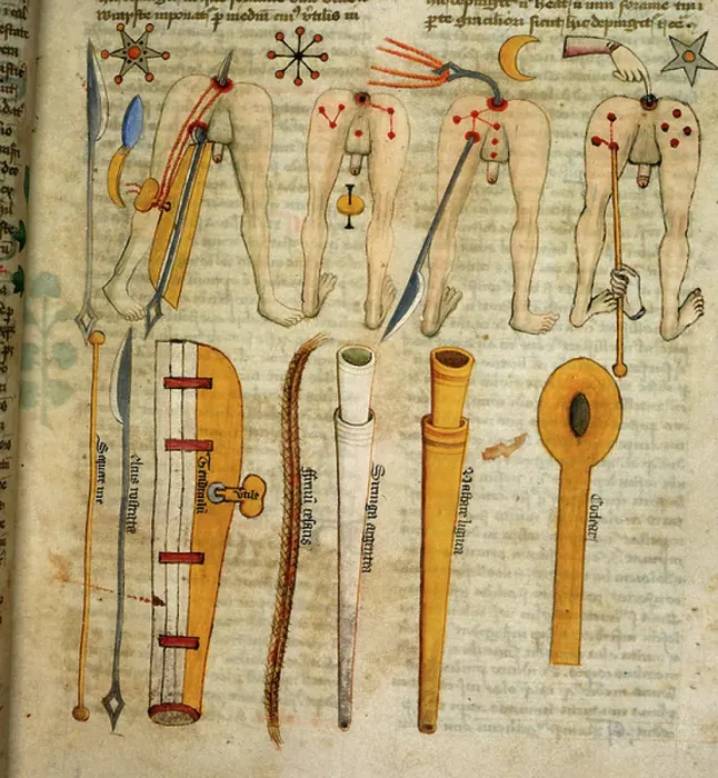 Framed Print : Instruments for the examination of the anus