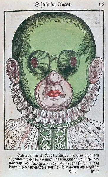 Mask for treating a strabismus, from Ophthalmodouleia