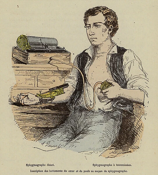 Measuring a man's blood pressure using a sphygmograph (coloured engraving)