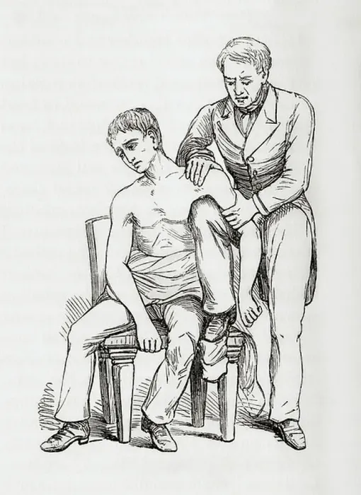 Framed Print : Method of reducing dislocation of the shoulder with knee in armpit