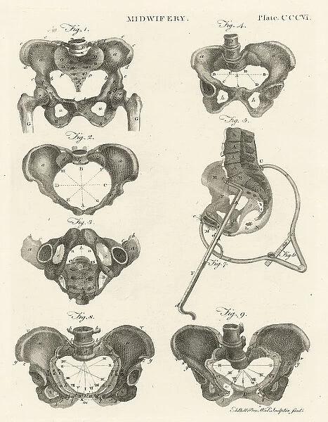 Midwifery, illustration from Encyclopedia Britannica, published in Edinburgh