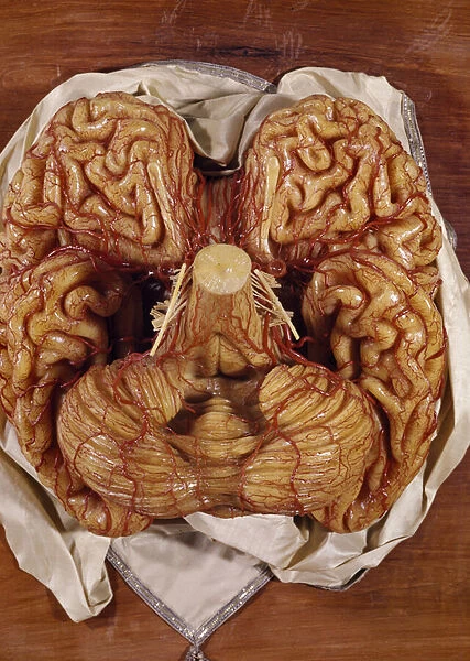 Model of a brain (wax)