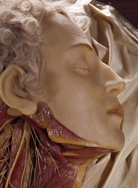Model of a man whose throat has been cut (wax)