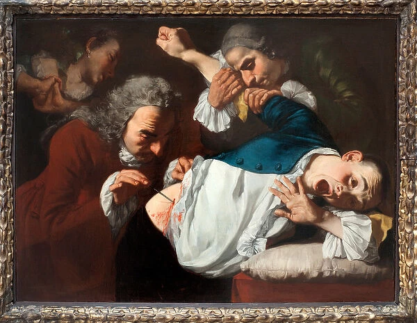 The Operation, 1753-54 (oil on canvas)