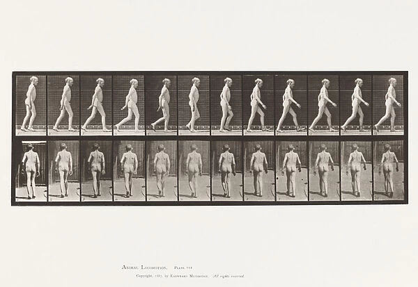 Plate 562. Lateral Curvature of Spine; Walking, 1885 (collotype on paper)