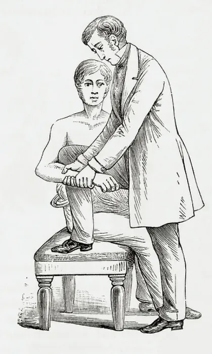 Framed Print : Reduction of dislocation of elbow