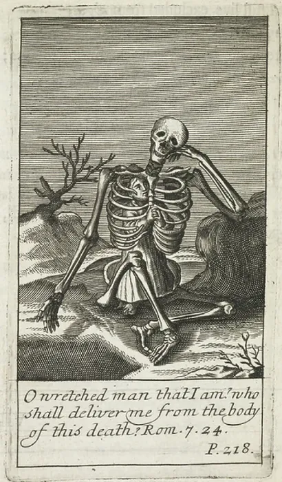 Framed Print : A skeleton