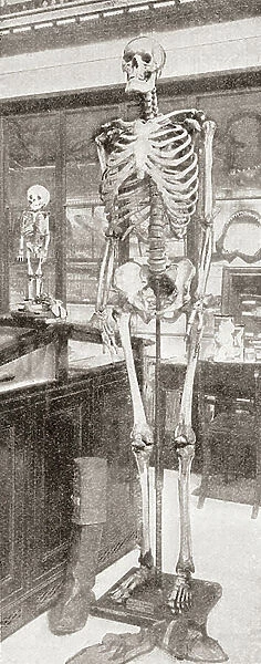 The skeletons of Charles Byrne, 1761-1783, 'The Irish Giant' right and on the left Caroline Crachami, c. 1815--1824, 'The Sicilian Dwarf'. From The Strand Magazine, published 1896