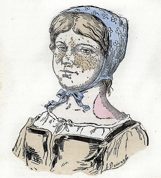 A young girl with a Sunburn Engraving from 'Nature and Man' by Rengade 1881 Private collection