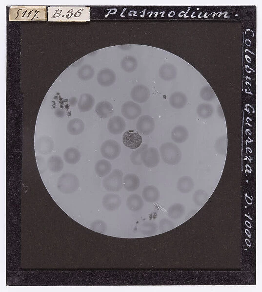 Plasmodium of the Colobus Guereza monkey, enlarged under a microscope