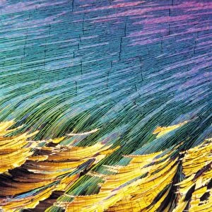 Cortisol crystals, light micrograph