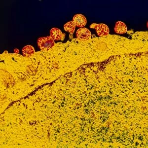 False-colour TEM of Mycoplasma sp