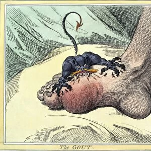 Gout, 18th-century caricature