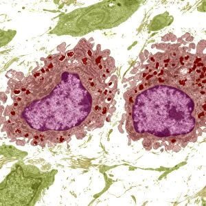 Macrophage cells, TEM