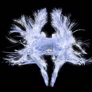 White matter fibres of the human brain C014 / 5672