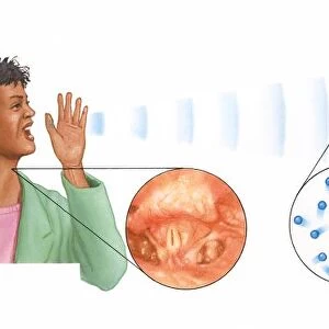 Illustrations of woman shouting showing sound waves and insets of vocal cords, rarefaction and compr