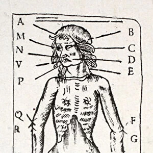A body which has been under the scalpel, with veins labelled (litho)