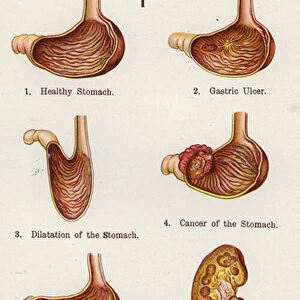 Diseases of the Stomach and Kidneys (colour litho)