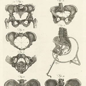 Midwifery, illustration from Encyclopedia Britannica, published in Edinburgh