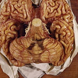Model of a brain (wax)