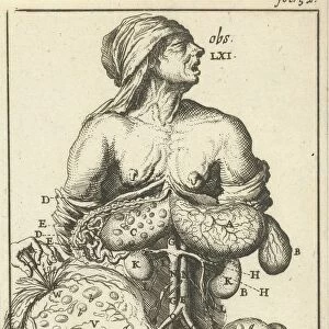 Anatomical image II Print upper right fol 52