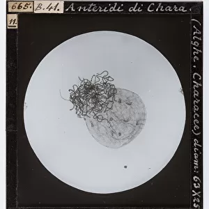 Chara anteride (alga characea): male reproductive organ enlarged under a microscope