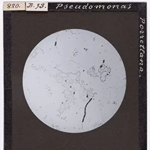 Pseudomonas Porrettana enlarged under a microscope