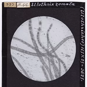Ulothrix zonata, belonging to the Ulothrichea class, enlarged under a microscope