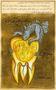 Dentistry Prints: anatomical view of a tooth, the source of toothache is shown as a demon of hell