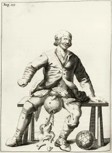 Draining fluid from a Hydrocele of the Scrotum, from 'Exercitationes Practicae circa Medendi Methodum" Draining fluid from a Hydrocele of the Scrotum, from 'Exercitationes Practicae circa Medendi Methodum"