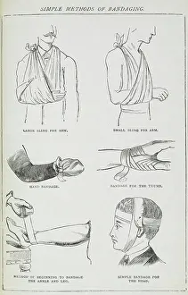 Ill Health Prints: Simple Methods of Bandaging